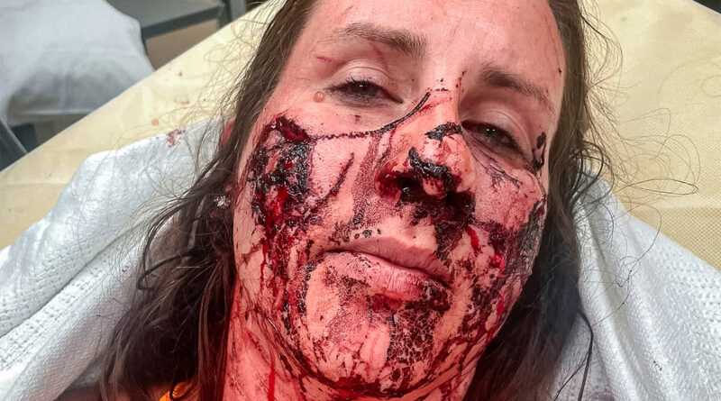 Otter Attacks and Severely Mauls 3 Women Floating Montana River - Survive - News